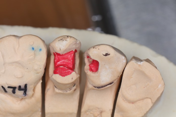 Matt Dodson #5-6 model