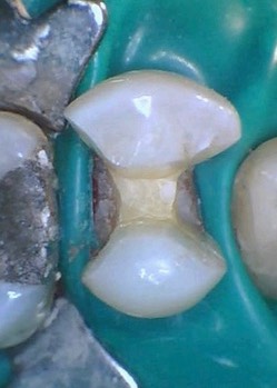 Mendel Sato #12 prep