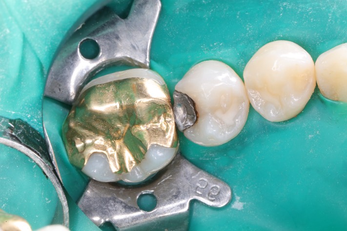 Mendel Sato #29 pre-op