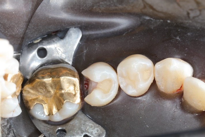 Mendel Sato #29 prep