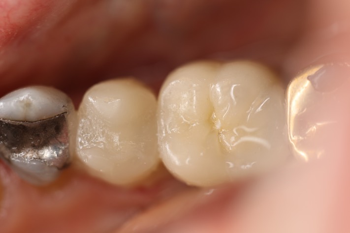 Mendel Sato #30 temp