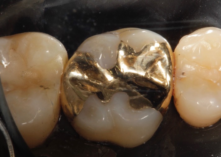 Mitchell Chun #14 finish