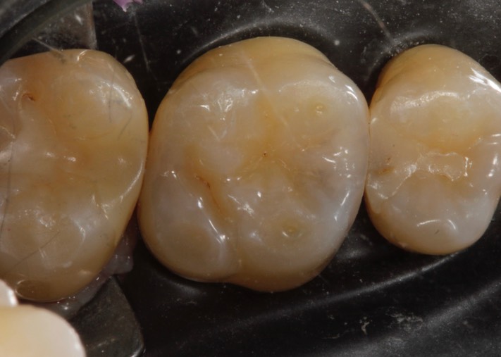 Mitchell Chun #14 pre-op