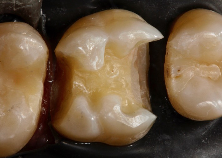 Mitchell Chun #14 prep 