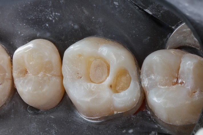 Mitchell Chun #14 prep