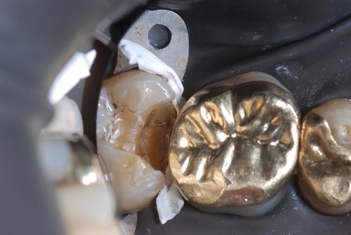 Mitchell Chun #15 pre-op