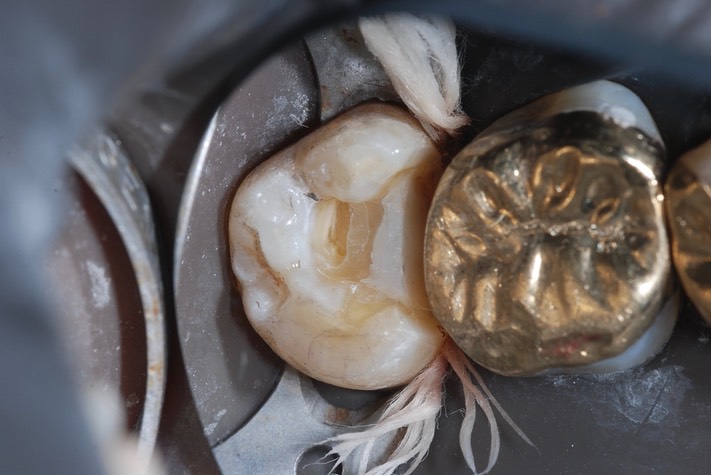 Mitchell Chun #15 prep