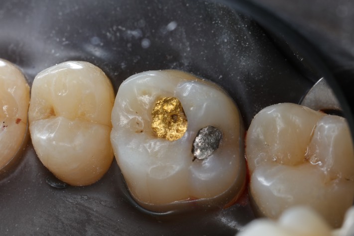 Mitchell Chun #3 pre-op