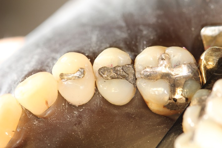 Nina Hayashi #4 pre-op