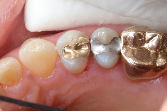 Russ Tabata #5 finish