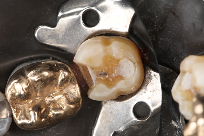 Russ Tabata #18 prep