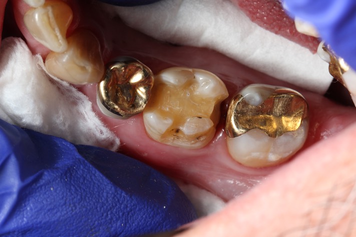 Russ Tabata #30 prep