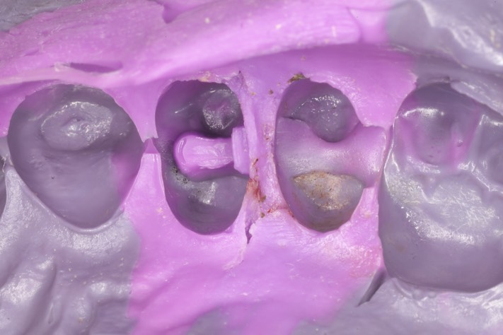 Russ Tabata #5 impression