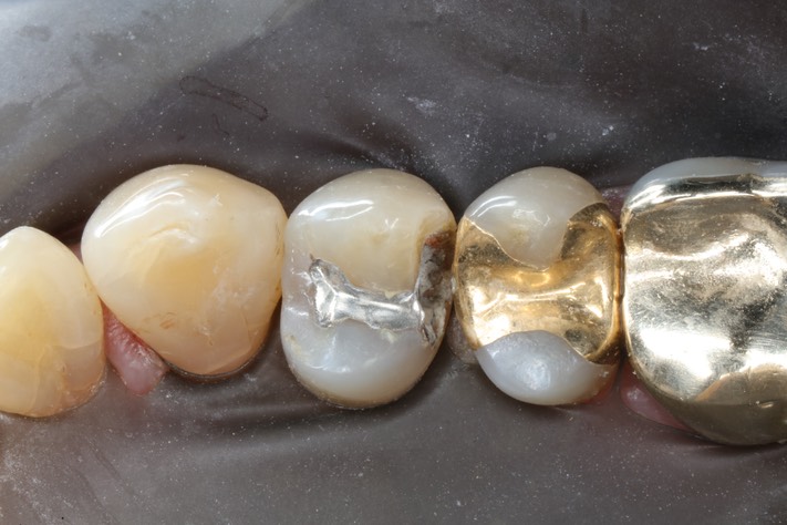 Russ Tabata #5 pre-op