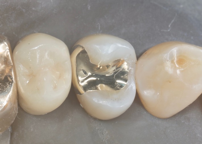 Scott Kanamori #12 finish