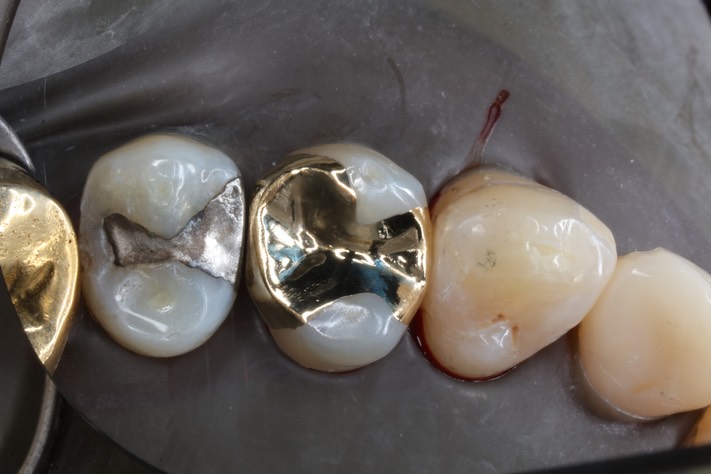 Scott Kanamori #12 finish