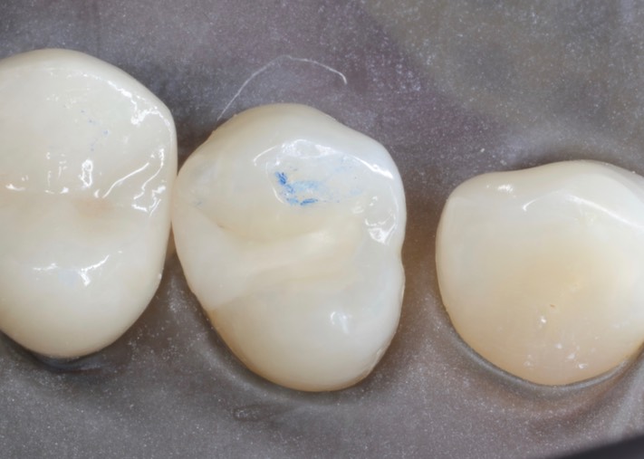 Scott Kanamori #12 pre-op