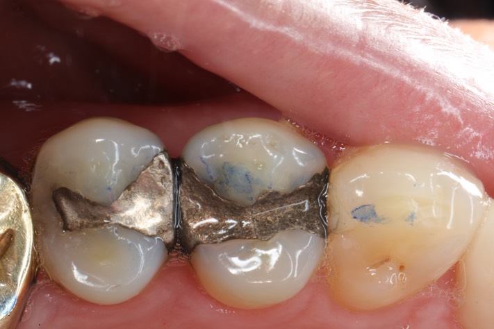 Scott Kanamori #12 pre-op