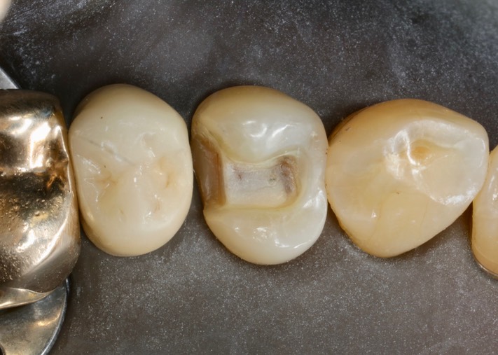 Matt Dodson  #12 prep