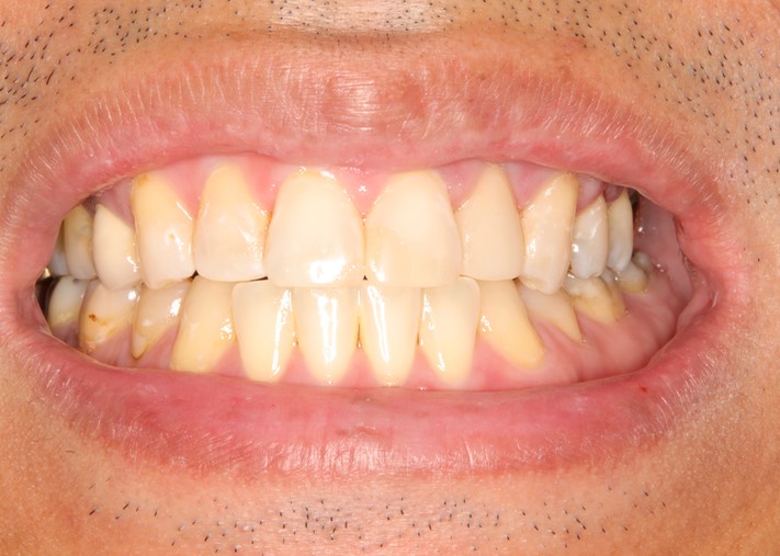 Scott Kanamori #12 smile 2