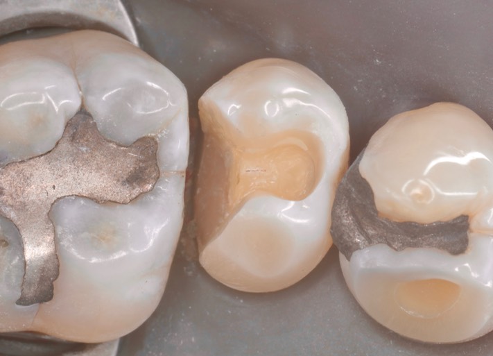 Scott Kanamori #13 prep 