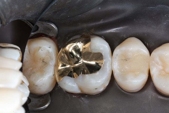 Scott Kanamori #14 finish