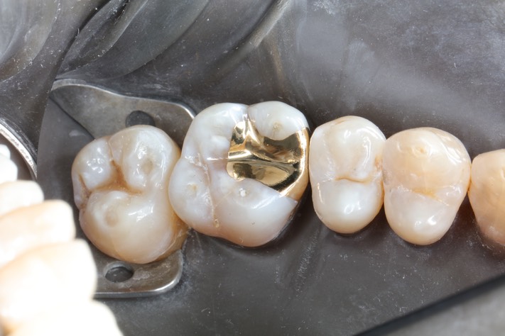 Scott Kanamori #14 finish