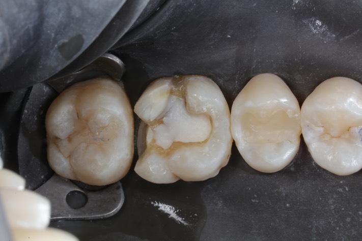 Scott Kanamori #14 prep