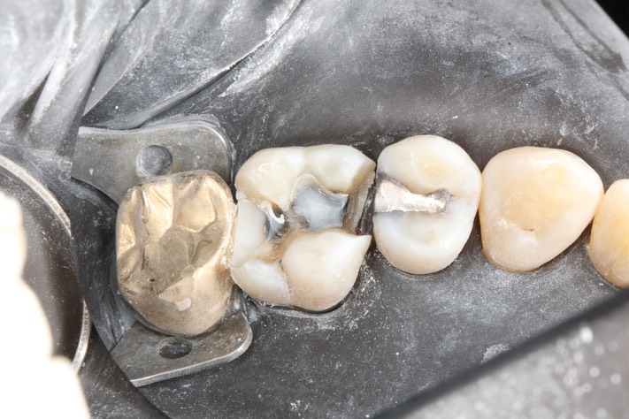 Scott Kanamori #14 temporized