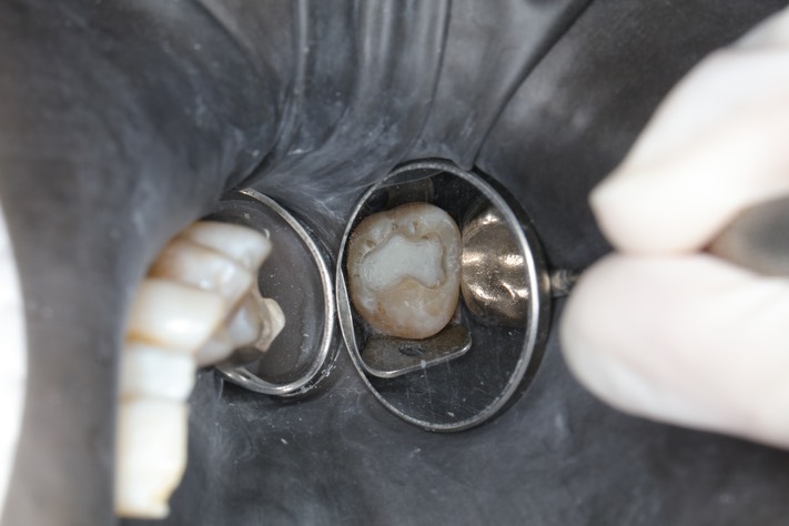 Scott Kanamori #15 prep