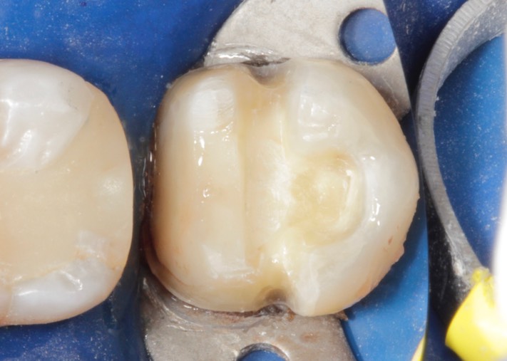 Scott Kanamori #18 prep