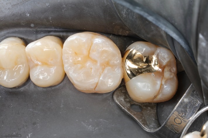 Scott Kanamori #2 finish