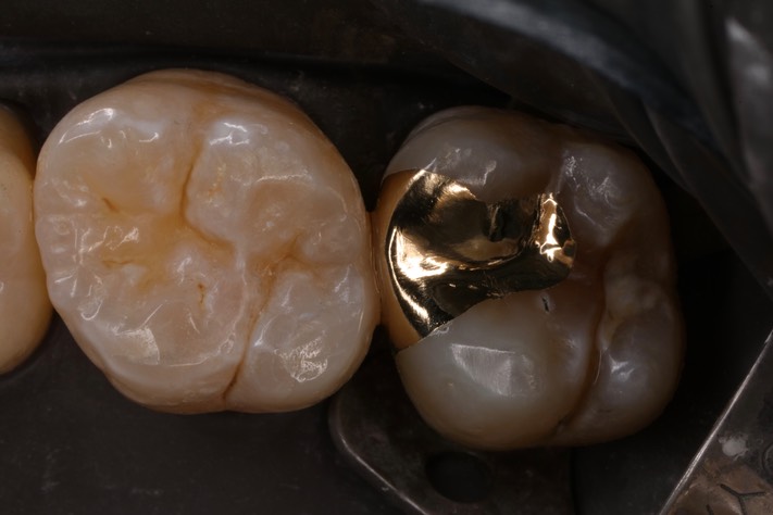 Scott Kanamori #2 finish