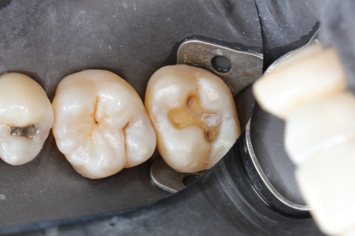 Scott Kanamori #2 prep