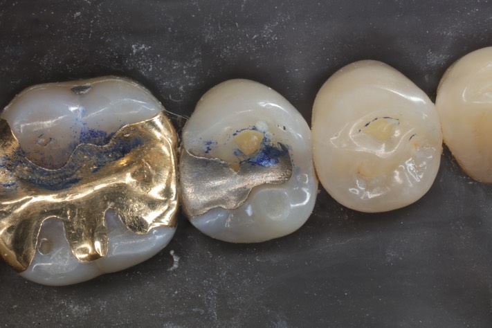 Scott Kanamori #29 pre-op