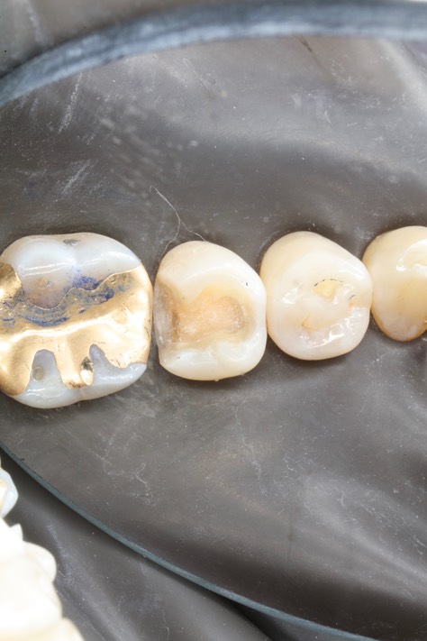 Scott Kanamori #29 prep