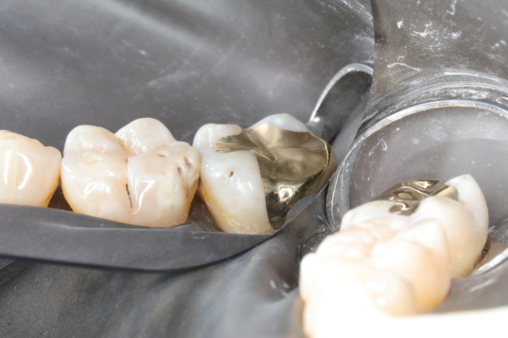 Scott Kanamori #31 finish buccal