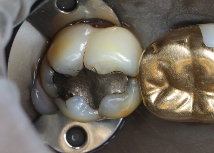 Scott Kanamori #31 pre-op