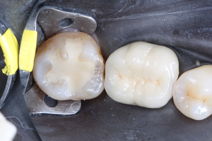 Scott Kanamori #31 pre-op