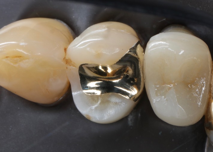 Scott Kanamori #5 finish