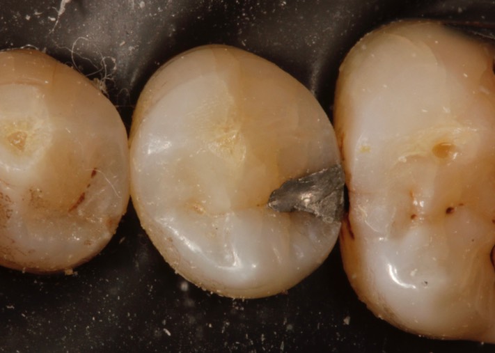 Ted Dodson #20 pre-op