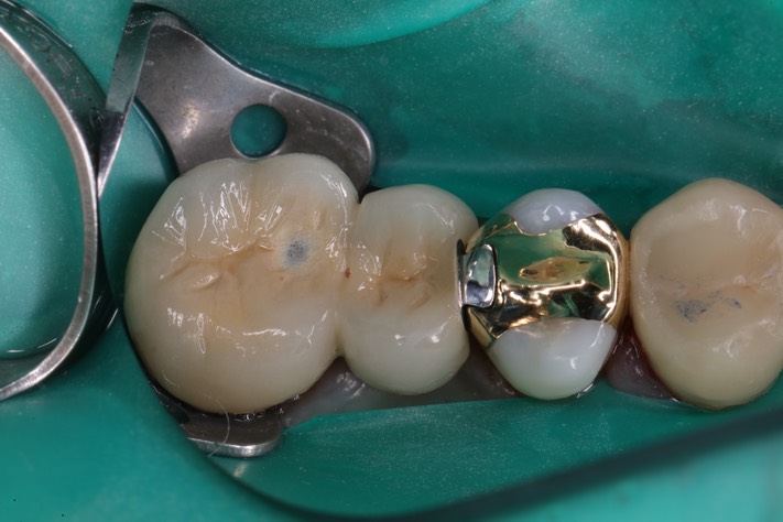 Ted Kanamori #12-14 finish