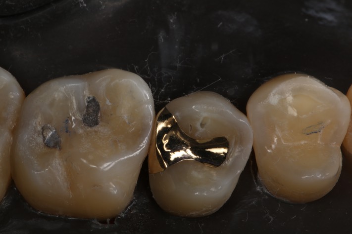 Ted Kanamori #13 finish