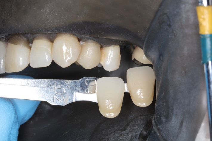 Ted Kanamori #13 shade