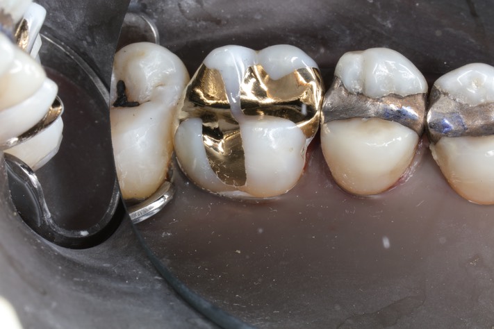 Ted Kanamori #14 finish