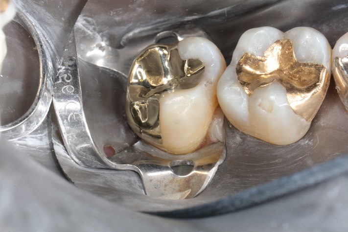 Ted Kanamori #15 finish