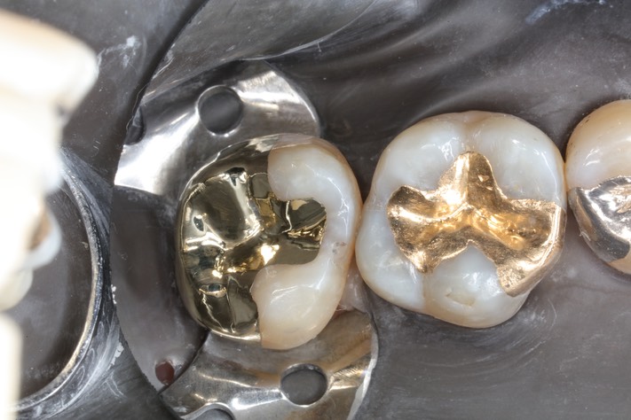 Ted Kanamori #15 finish