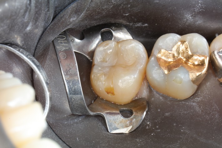 Ted Kanamori #15 pre-op