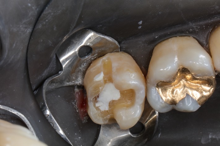 Ted Kanamori #15 prep