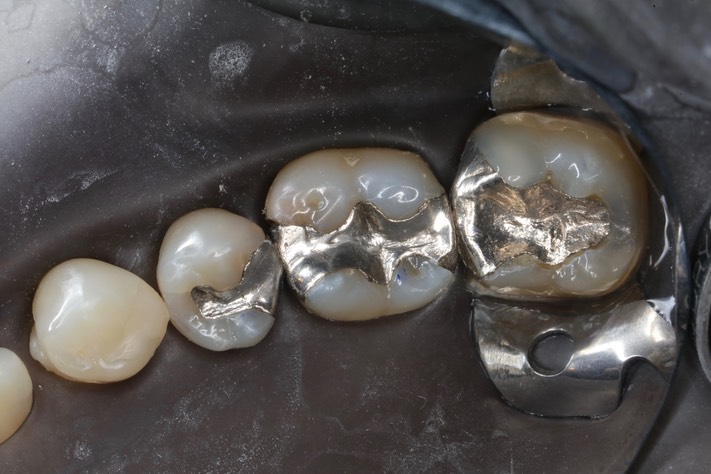 Ted Kanamori #18-19 pre-op